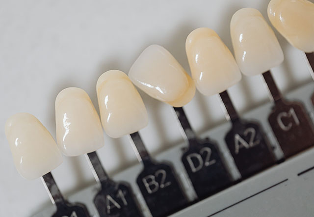 albirea dintilor Sibiu